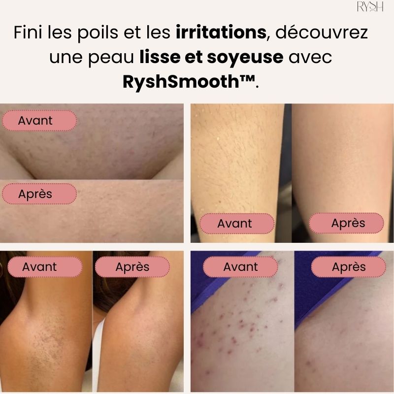 RyshSmooth™ – Le rasoir électrique sans fil