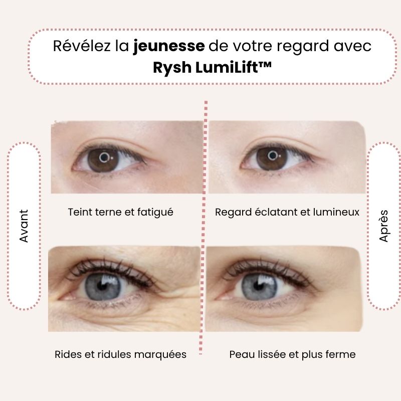 Rysh LumiLift™ – La technologie qui réveille votre beauté