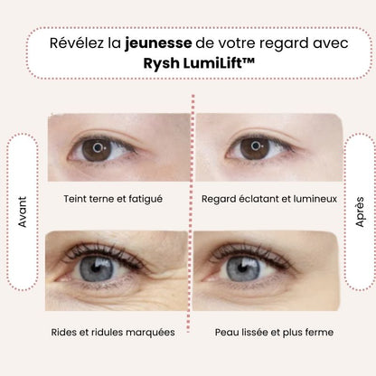 Rysh LumiLift™ – La technologie qui réveille votre beauté