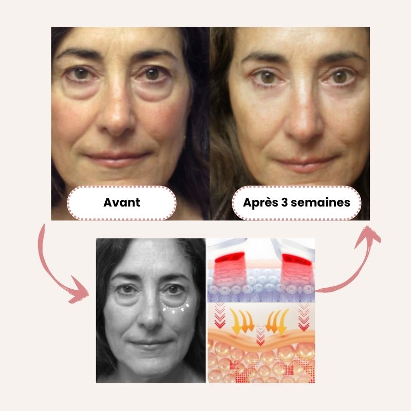 Rysh LumiLift™ – La technologie qui réveille votre beauté